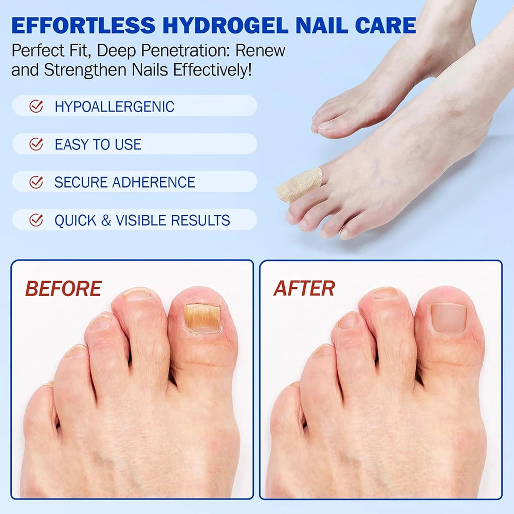 Nail Secure Repair Patch