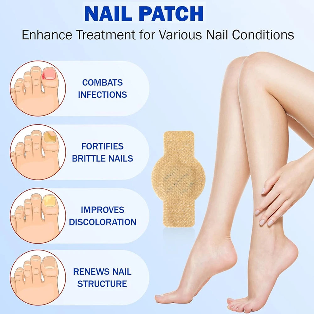 Nail Secure Repair Patch